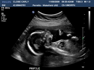 Profile Shot Of Bub