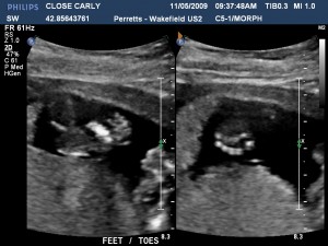 Hands & Feet / Fingers & Toes!
